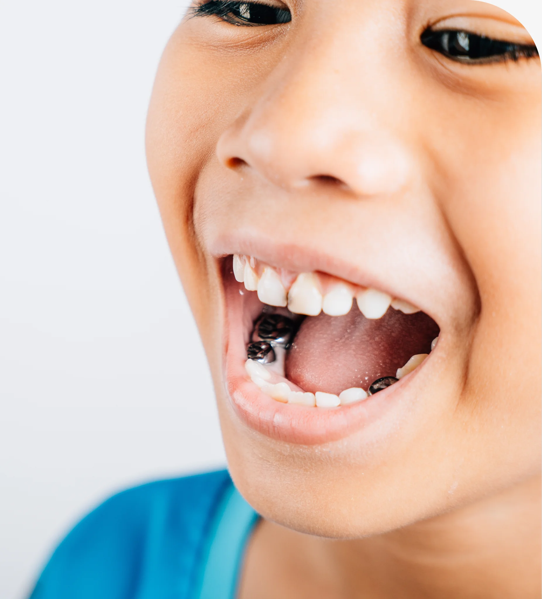 Pediatric Restorative Dentistry in Byron Center, MI banner